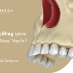 Sinus Lifting (Sinüs Kaldırma) İşlemi Nedir, Nasıl Yapılır?