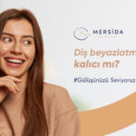 Diş Beyazlatma Kalıcı mı?