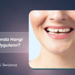 Diş Kırığında Hangi Tedavi Uygulanır? Tüm Tedavi Seçenekleri