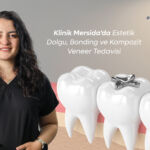Klinik Mersida’da Estetik Dolgu, Bonding ve Kompozit Veneer Tedavisi