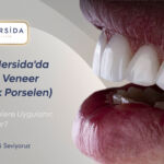 Klinik Mersida’da Lamine Veneer (Yaprak Porselen)