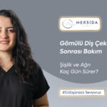 Gömülü Diş Çekimi Sonrası Bakım: Şişlik ve Ağrı Kaç Gün Sürer? | Klinik Mersida